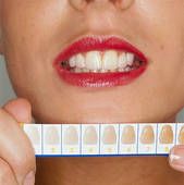 teeth photo white.jpg